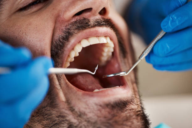 Dental X-Rays and Imaging in Des Peres, MO